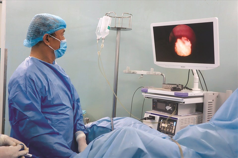 Dùng laser tán vỡ sỏi to trong bàng quang. Ảnh: T.A Dùng laser tán vỡ sỏi to trong bàng quang. Ảnh: T.A