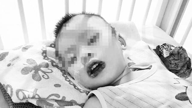 Bệnh nhi đang hồi phục dần. Ảnh bệnh viện cung cấp.