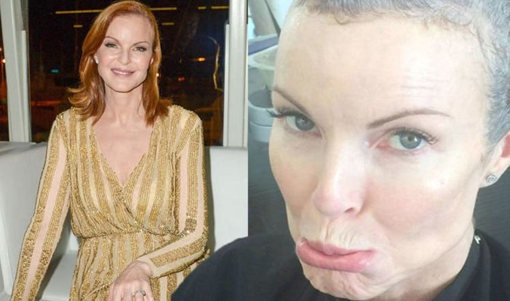 Marcia Cross