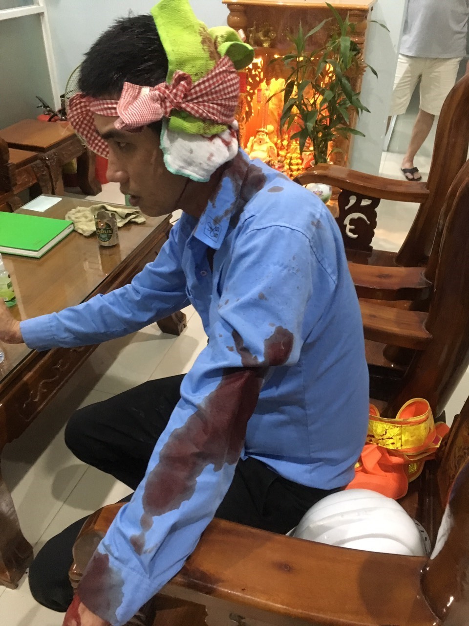 Một trong 2 nhân viên BOT Ninh Xuân bị các đối tượng Xuân và Ánh đánh trọng thương. Ảnh: Đức Trọng