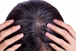 Những lí do khiến tóc bạc khi còn trẻ