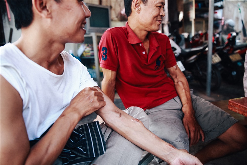 Tồn tại đã hơn 20 năm, “xóm chạy thận” chứng kiến nhiều lớp người đến và đi, già có, trẻ có. Đến đây là không hẹn ngày về nữa vì chẳng biết sẽ “ra đi” lúc nào. “Thôi còn ngày nào thì cố gắng ngày đó!”, người trong xóm vẫn thường cố động viên nhau như vậy.