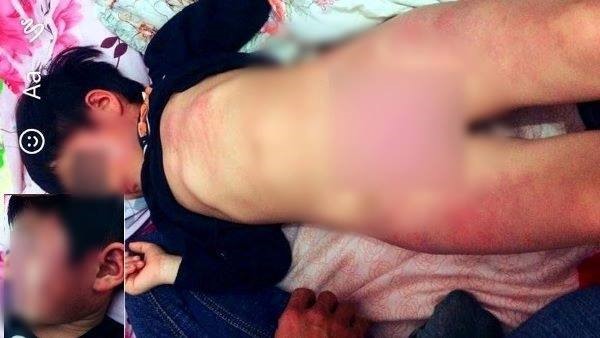 Bé bị nghi bạo hành ở lớp học. Ảnh: FB.