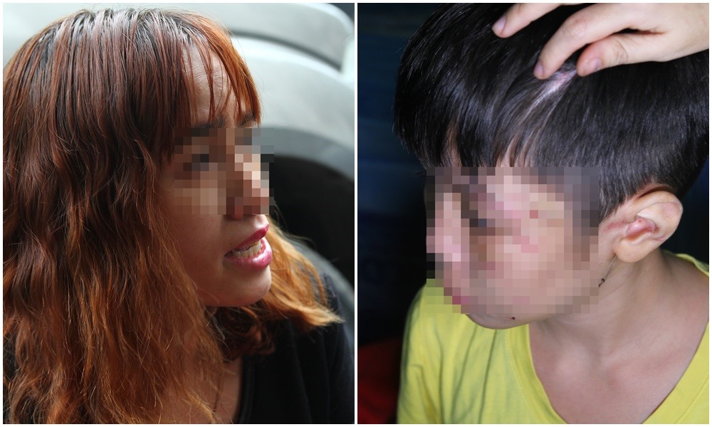 Cháu bé bị bạo hành và mẹ ruột.