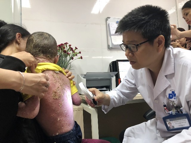 PGS Lê Hữu Doanh thăm khám cho cháu Thuyên. Ảnh: BV
