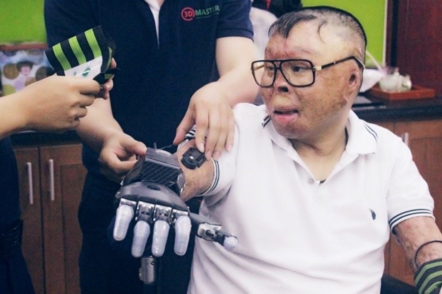 Sau bài viết của báo Lao Động, các nhà hảo tâm đã giúp chiến sĩ Đinh Văn Dương có được đôi tay giả.