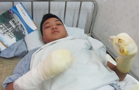 Quang phải nằm viện nhiều tháng do vết thương nặng. Ảnh: CAND