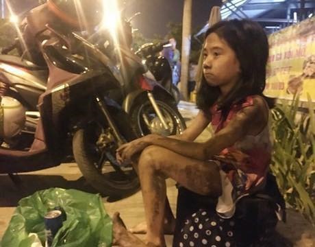 Trẻ em thất thần, hoảng loạn sau vụ cháy kinh hoàng.