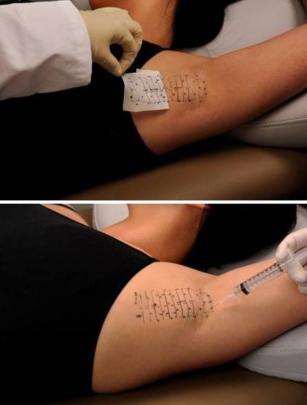 Quá trình chữa bệnh bằng phương pháp mới (Ảnh: BSCC)