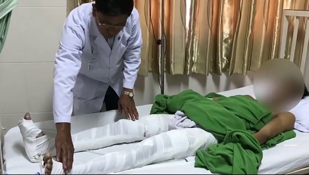 Anh N.V.M bị gãy cả hai xương đùi hiện đang nằm điều trị ở Bệnh viện Đa khoa Hoàn Mỹ Cửu Long (Cần Thơ)