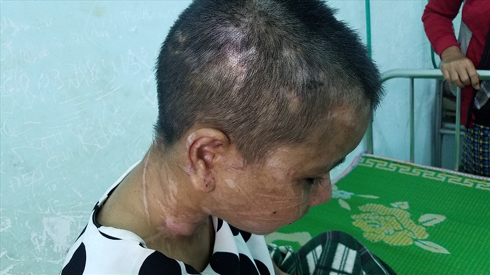 Hình ảnh Y Nhiêu bị bạo hành. Ảnh Đình Văn