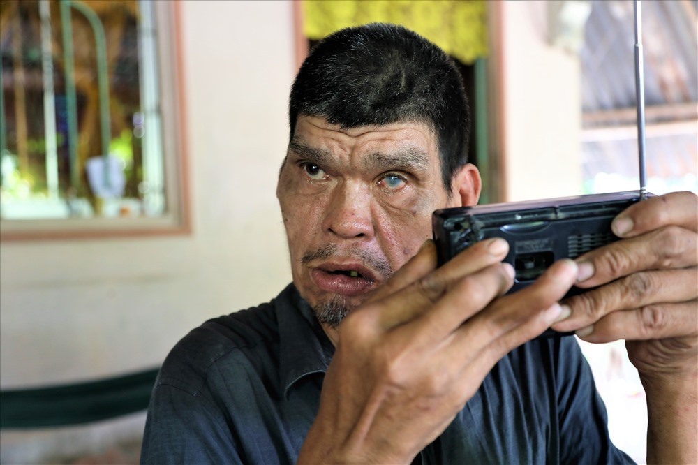 Sống côi cút trong quãng đời còn lại, ông Y làm bạn với chiếc radio để nghe cải lương, vọng cổ. Ảnh: Trường Sơn