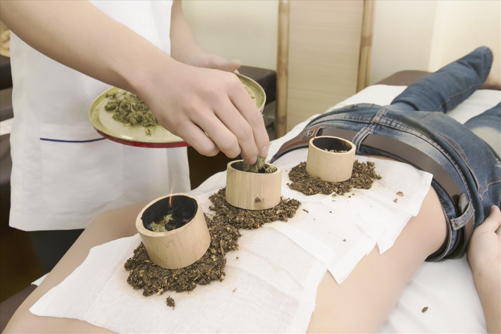 Kỹ thuật trị liệu thoát vị đĩa đệm từ “ống tre”
