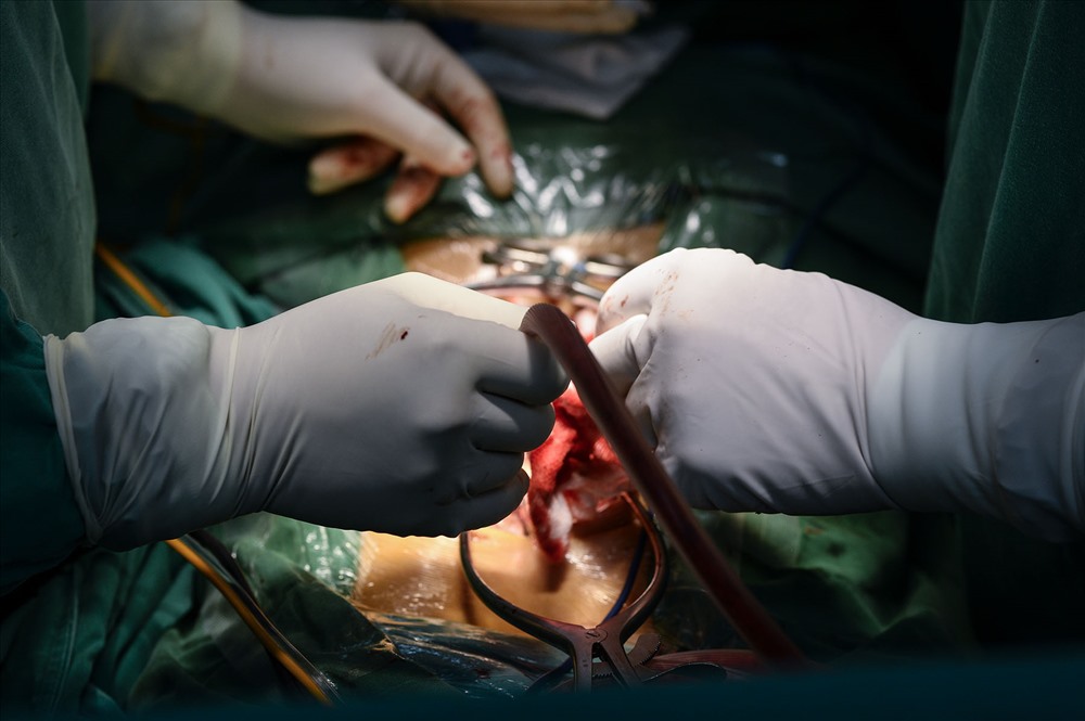 Tại phòng mổ bên cạnh, GS.BS Jorge Knorr Gimenez, Trưởng Khoa Chấn thương Chỉnh hình, BV trường ĐH Sant Joan de Déu de Barcelona (Tây Ban Nha) đang phẫu thuật xương chậu cho bé gái 5 tuổi.