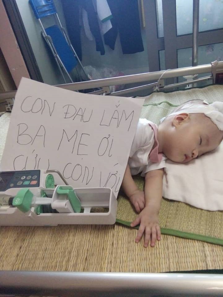 Bảo An bị bệnh não úng thủy, qua nhiều lần phẫu thuật vẫn chưa khỏi. Ảnh PV