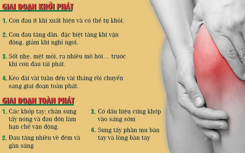 2 giai đoạn triệu chứng điển hình của viêm khớp dạng thấp