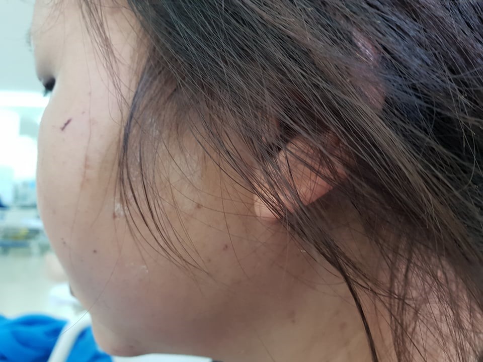 Cô gái kể thường xuyên bị chủ quán dù tua vít, mũ bảo hiểm, dao đánh đập tàn nhẫn.