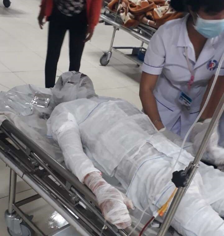 An injured person is being pressed at the hospital.