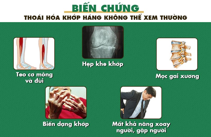 Thoái hóa khớp háng gây ra nhiều biến chứng nguy hiểm nếu không được phát hiện và điều trị kịp thời