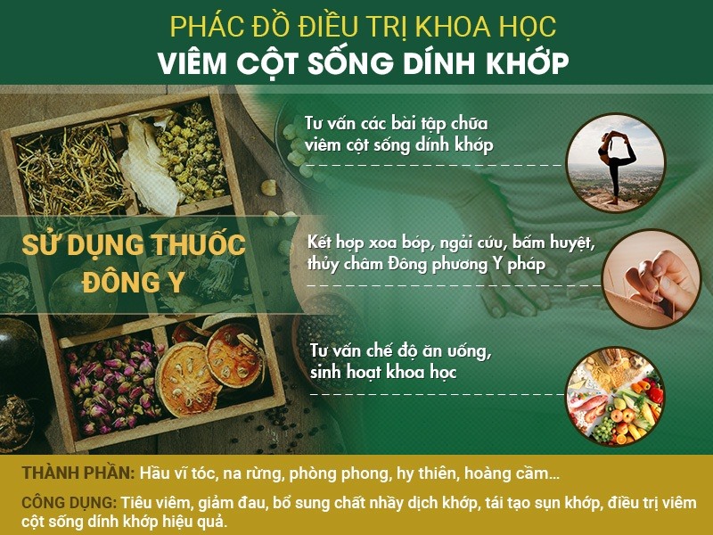Điều trị viêm cột sống dính khớp toàn diện