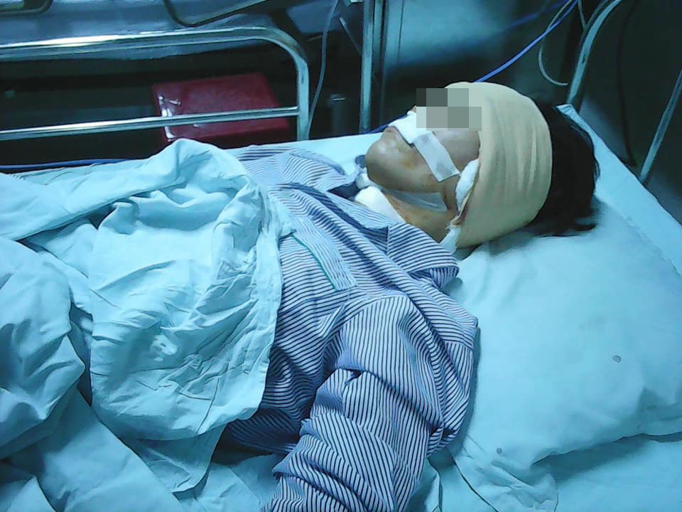 Chị H đang được điều trị tại bệnh viện. Ảnh: FB/Nguyen Huu Thuyen