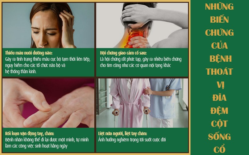 Một số biến chứng nguy hiểm của bệnh thoát vị đĩa đệm cột sống cổ