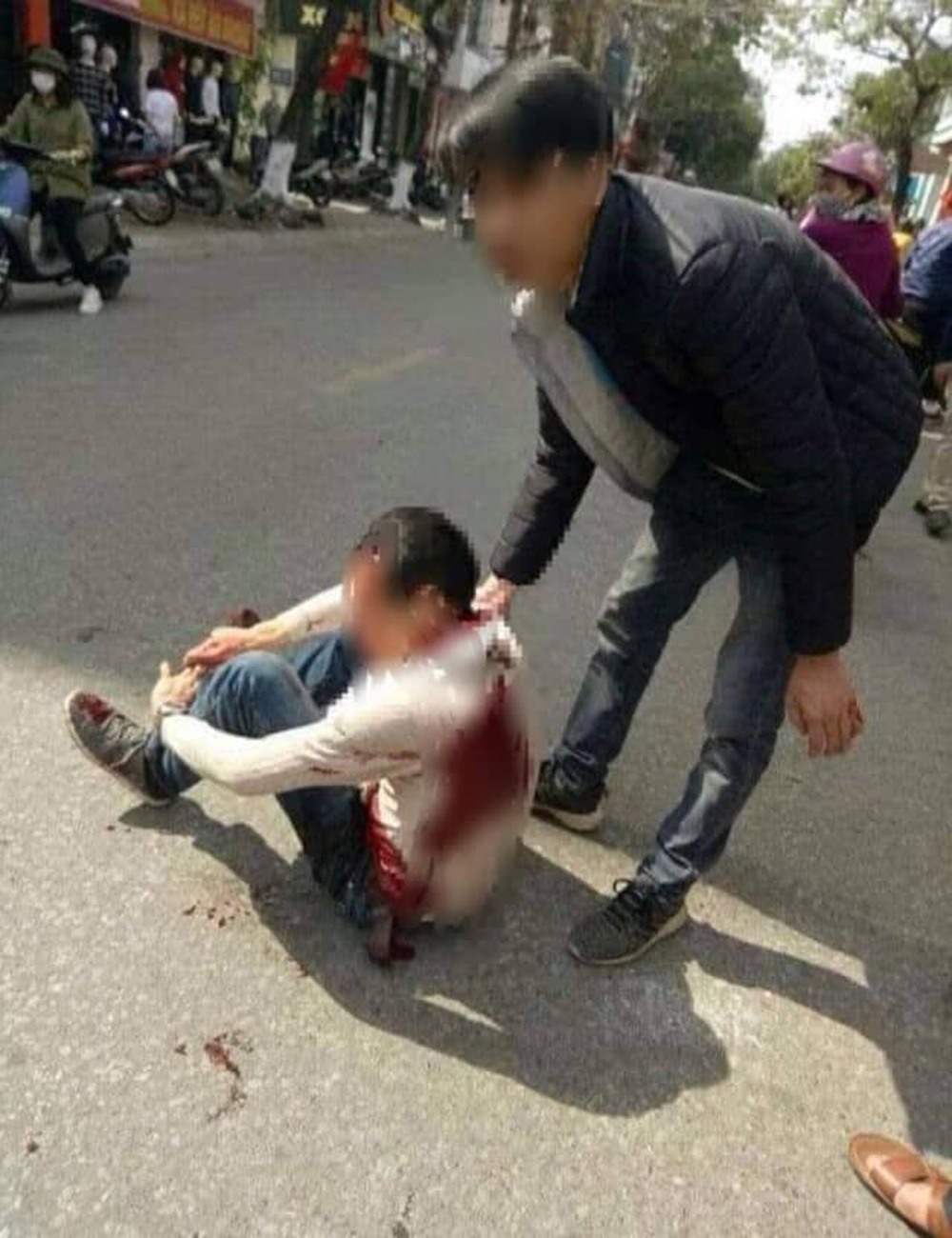 Nạn nhân bị thương nặng được mọi người đưa đi viện cấp cứu.