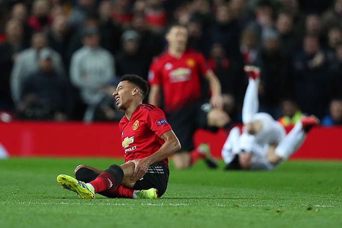Chấn thương của Martial hay Lingard đều khiến HLV Solskjaer đau đầu (Ảnh: Getty)