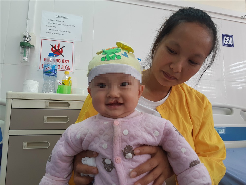 Hình ảnh các bé khuyết tật khe hở môi vòm miệng được phẫu thuật trong tháng này. Ảnh: Thùy Linh