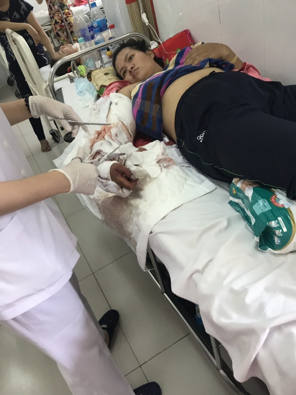 Các bác sĩ chăm sóc cánh tay bị phỏng của nạn nhân.