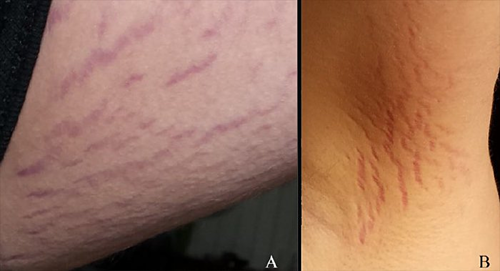 Các vết thương trên cơ thể cậu bé. Ảnh: Journal of Central Nervous System Disease.