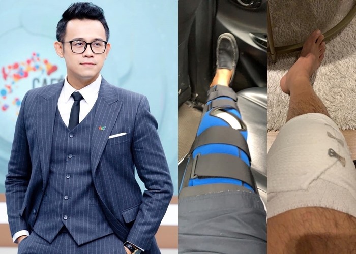 MC Đức Bảo phải mổ dây chằng đầu gối do chấn thương cũ.
