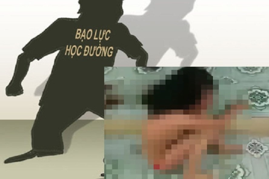 Nhiều bạn đọc tỏ ra phẫn nộ vụ nữ sinh bị đánh hội đồng dã man ở Hưng Yên.