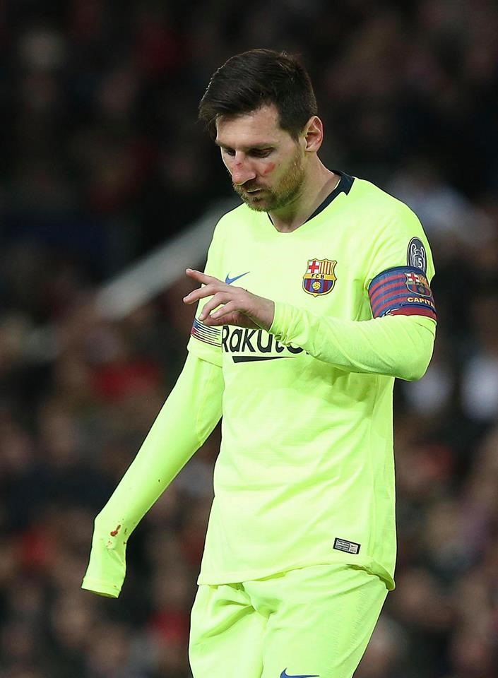 Messi chảy máu mũi sau pha va chạm với Smalling. Ảnh: MUFC.