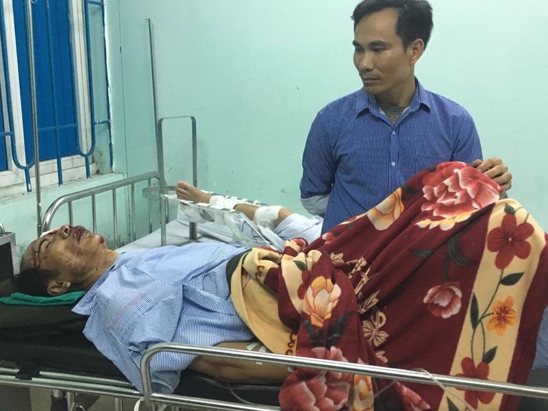 Nạn nhân đang điều trị tại viện 103 (Hà Đông, Hà Nội).