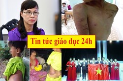 Tin tức giáo dục 24h: Choáng váng bé trai bị sư thầy đánh tím người