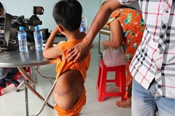 Vụ cô giáo đánh học sinh khuyết tật: Mẹ học sinh "nhờ" cô giáo đánh