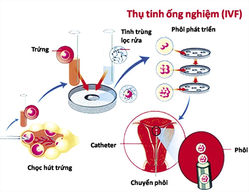 Quy trình thụ tinh trong ống nghiệm. Quy trình thụ tinh trong ống nghiệm.