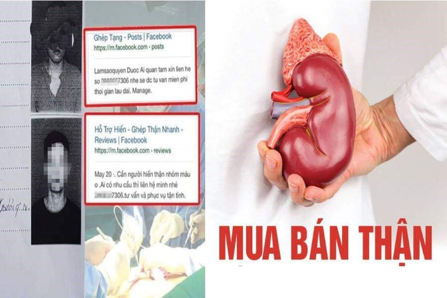 Buôn bán thận người: Đường dây dài đến đâu?