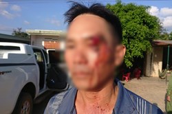 Cung cấp bằng chứng tố cán bộ xã nhận hối lộ, bị giang hồ vây đánh rách mặt