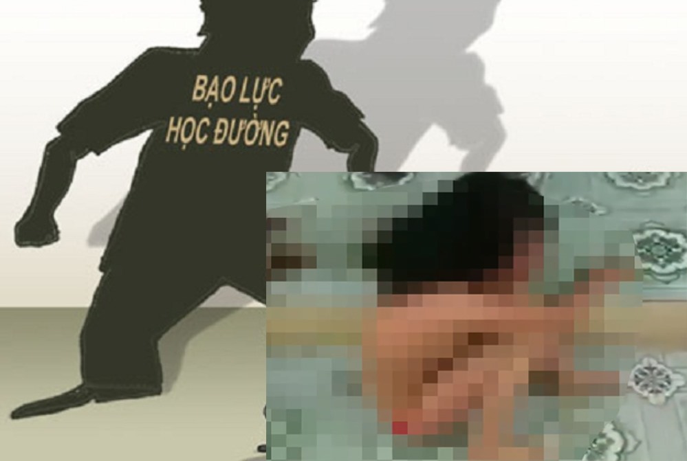 Kết quả hình ảnh cho vụ nữ sinh bá» Äánh