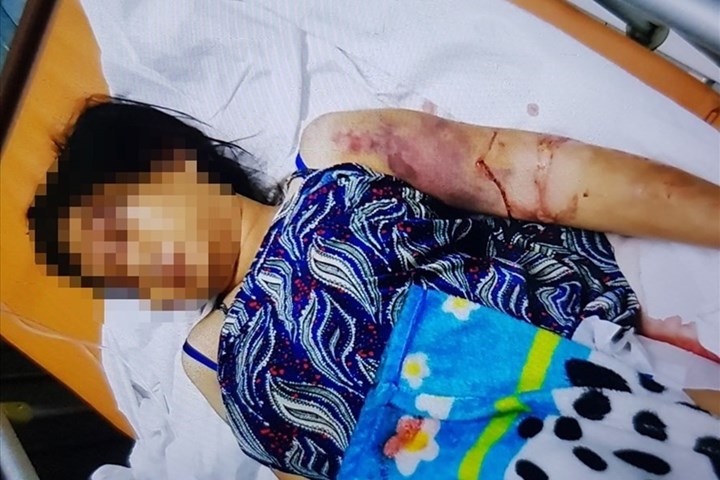 Thai phụ 18 tuổi bị tra tấn sẩy thai: Tội ác của cho vay nặng lãi!