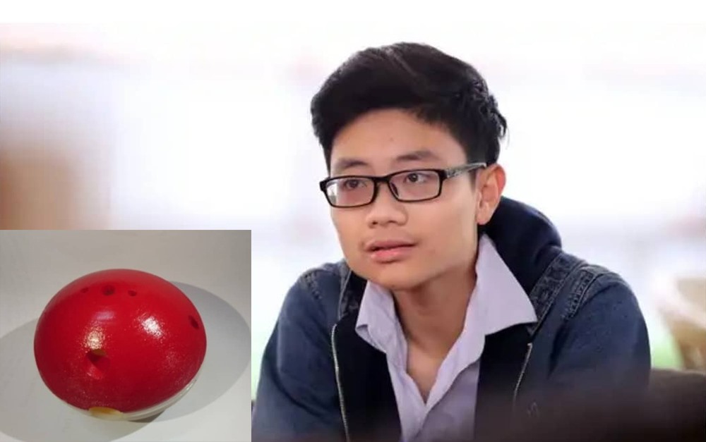 Việc bị ch&oacute; cắn đ&atilde; trở th&agrave;nh nỗi &aacute;m ảnh tuổi thơ, l&agrave; động lực để Minh chế tạo th&agrave;nh c&ocirc;ng sản phẩm. Ảnh: NVCC. 