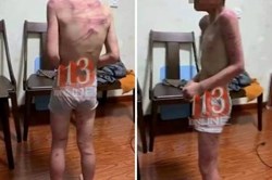 Thông tin bé trai bị cha dượng bạo hành ở Thanh Hóa là bịa đặt