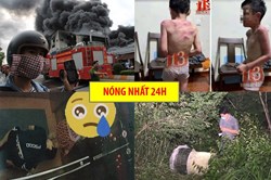 Nóng nhất 24h: Sự thật về bé trai bị cha dượng bạo hành ở Thanh Hóa
