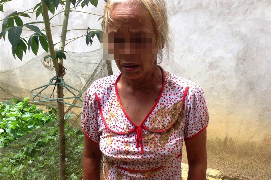 Bà Nguyễn Thị Thanh vẫn chưa hết hoảng loạn sau khi bị hành hung. Ảnh: Minh Lý